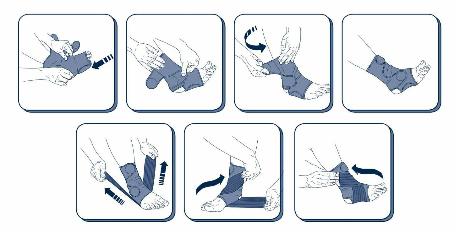 Fitting instructions for M-Brace Mercurio Ankle Lock.