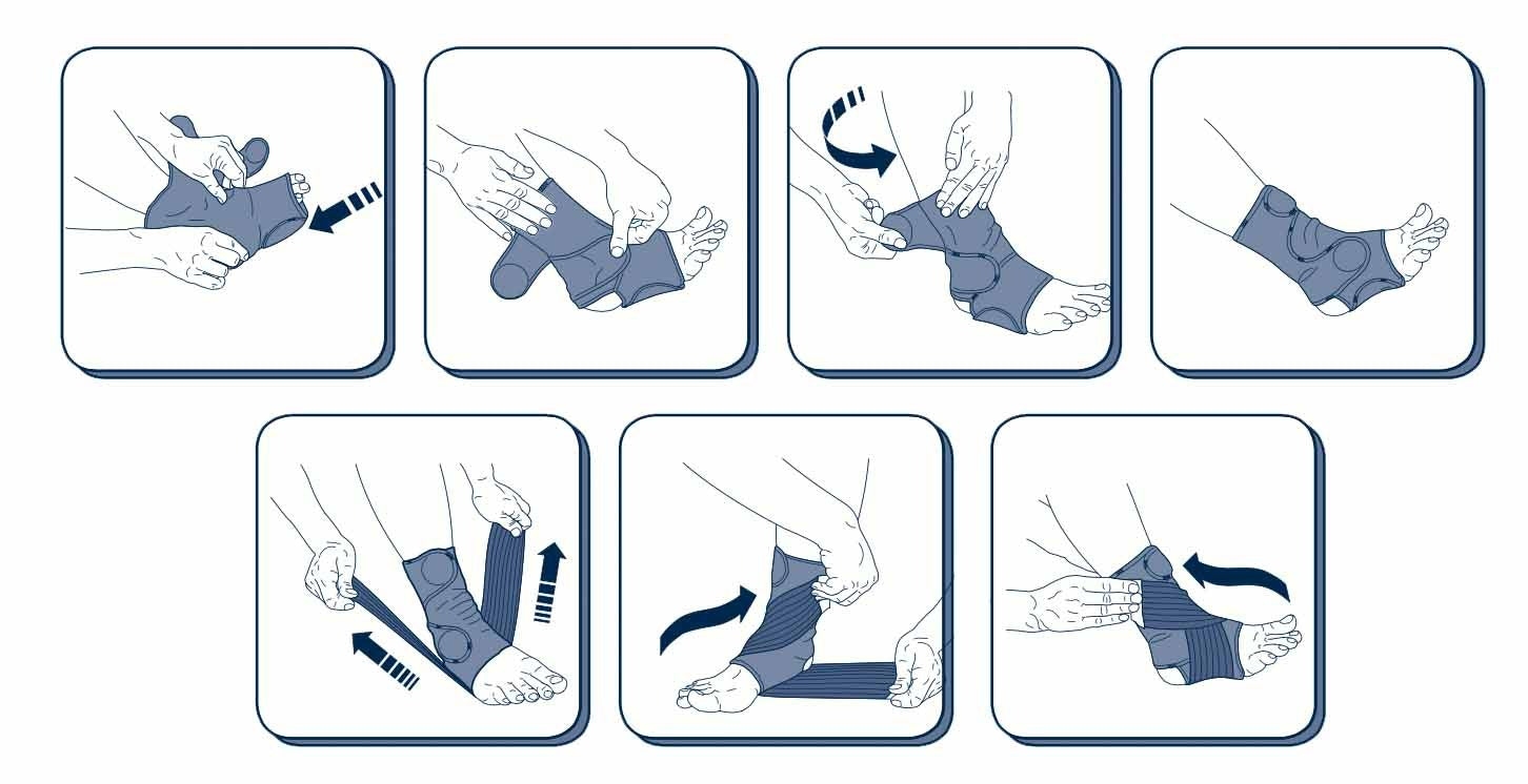 Fitting instructions for M-Brace Mercurio Ankle Lock.